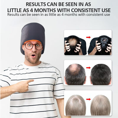 Topi Pertumbuhan Rambut 660nm Terapi Cahaya Merah LED dan 270 LED Cahaya Merah dan Topi Terapi Laser